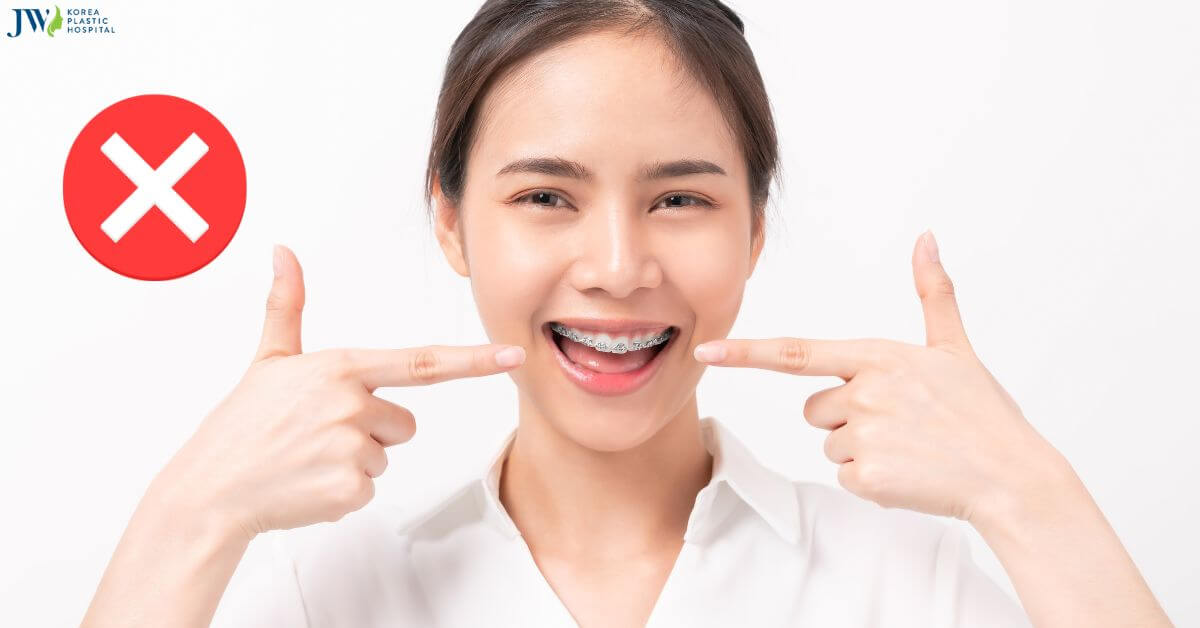 Những thói quen xấu khi niềng răng làm răng ngày càng tồi tệ hơn!