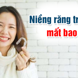 Niềng răng trong suốt mất bao lâu?