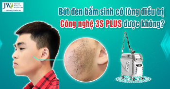 Điều trị bớt đen bẩm sinh – Bằng Công nghệ 3S PLUS