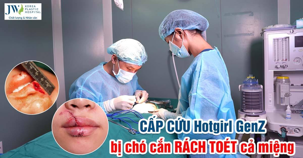chó cắn rách toét cả miệng