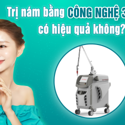 Trị nám bằng Công nghệ 3S PLUS có hiệu quả không?