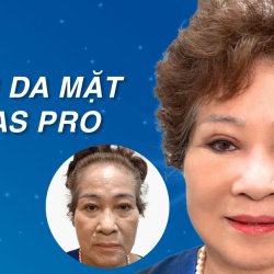 Căng da mặt SMAS PRO: Công nghệ diệu kỳ, giữ mãi nét xuân