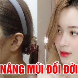 Sức mạnh phẫu thuật thẩm mỹ giúp cô gái đổi đời sau 1 đêm