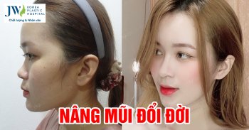 Sức mạnh phẫu thuật thẩm mỹ giúp cô gái đổi đời sau 1 đêm