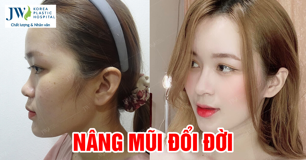 phẫu thuật thẩm mỹ