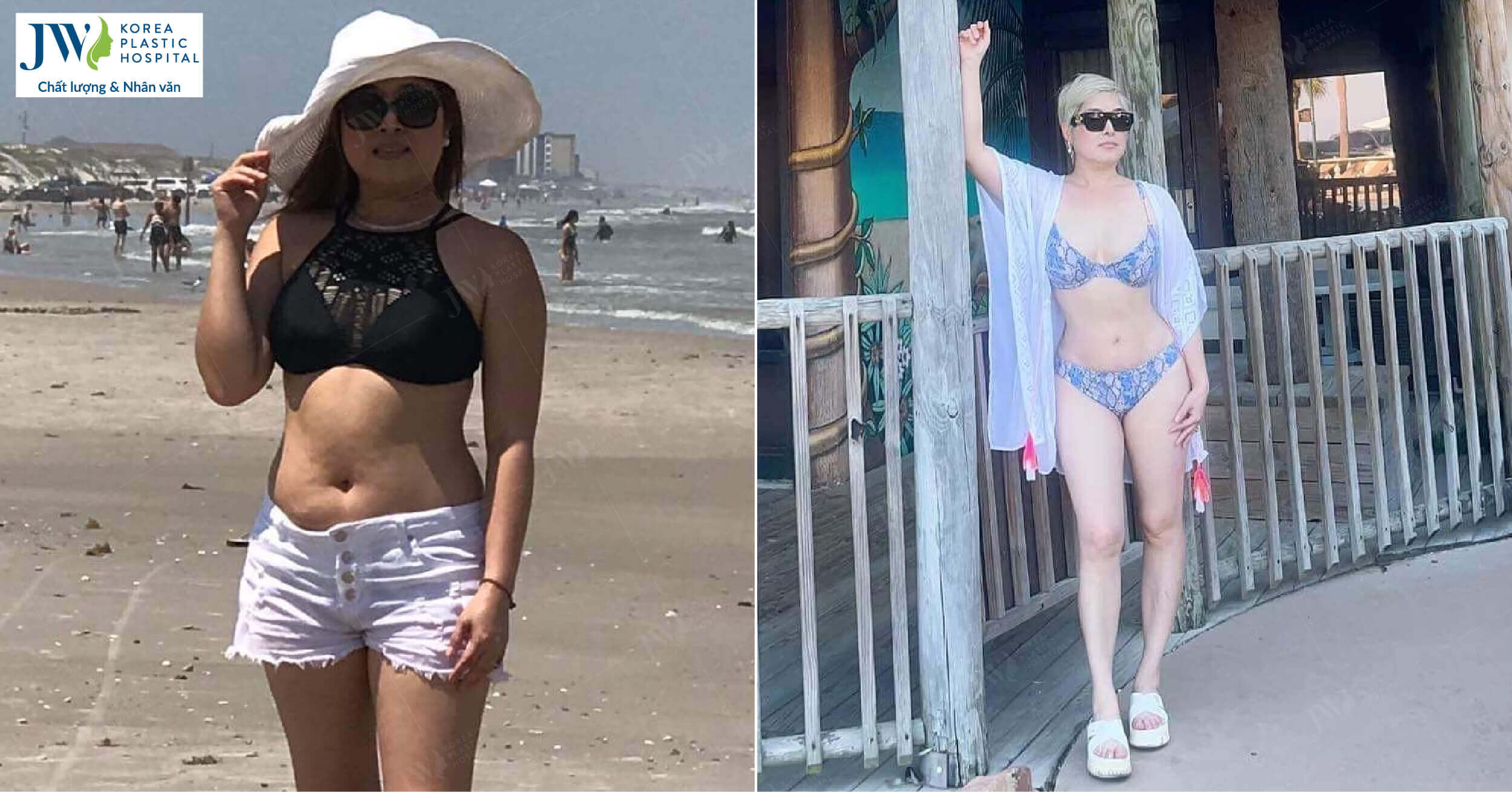 combo Nâng ngực + hút mỡ bụng