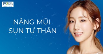 nâng mũi sụn tự thân