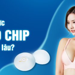 Nâng ngực Nano chip được bao lâu?