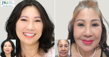 Việt kiều về nước