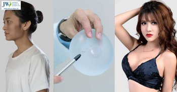 nâng ngực nội soi