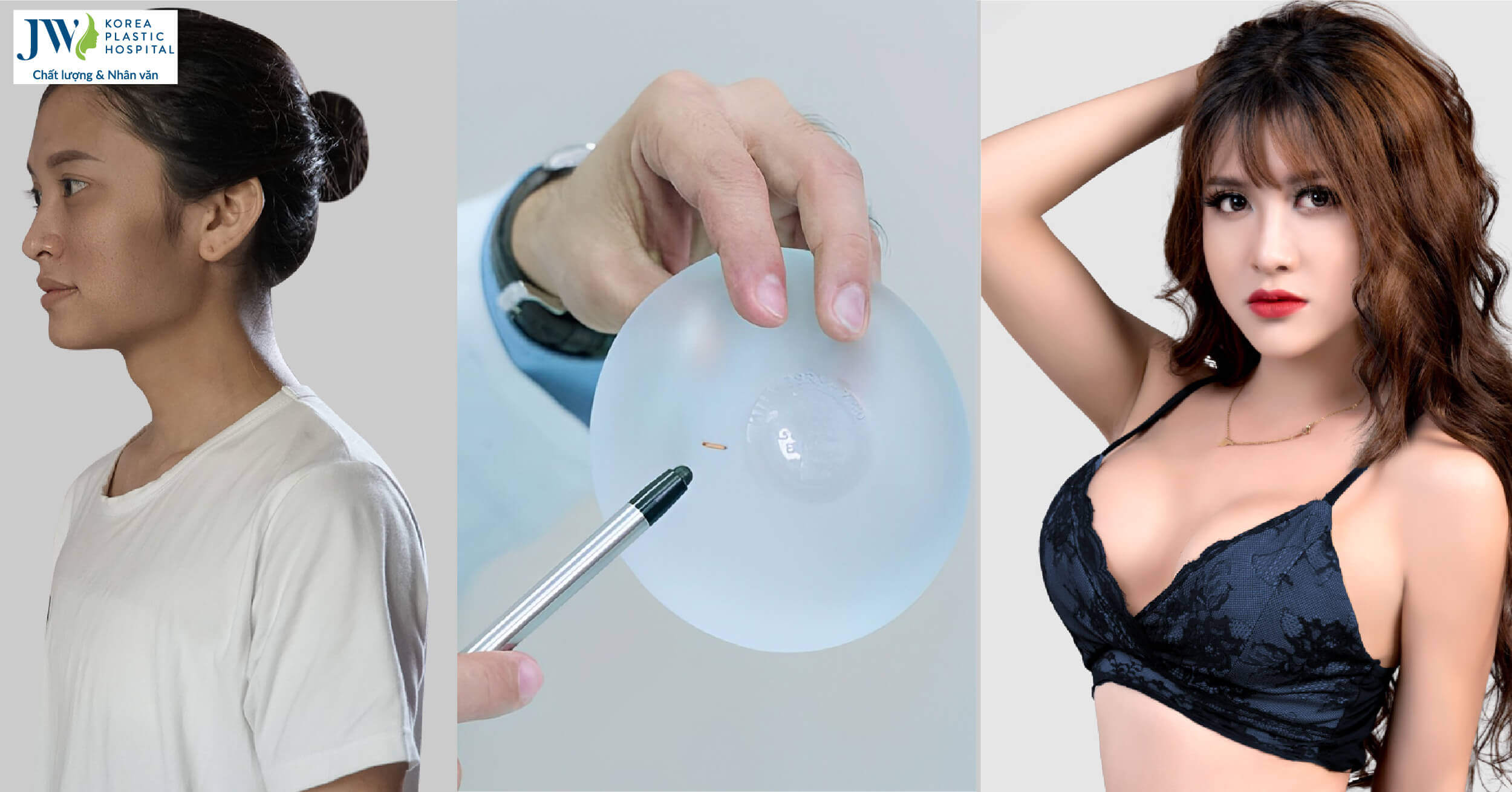 nâng ngực nội soi