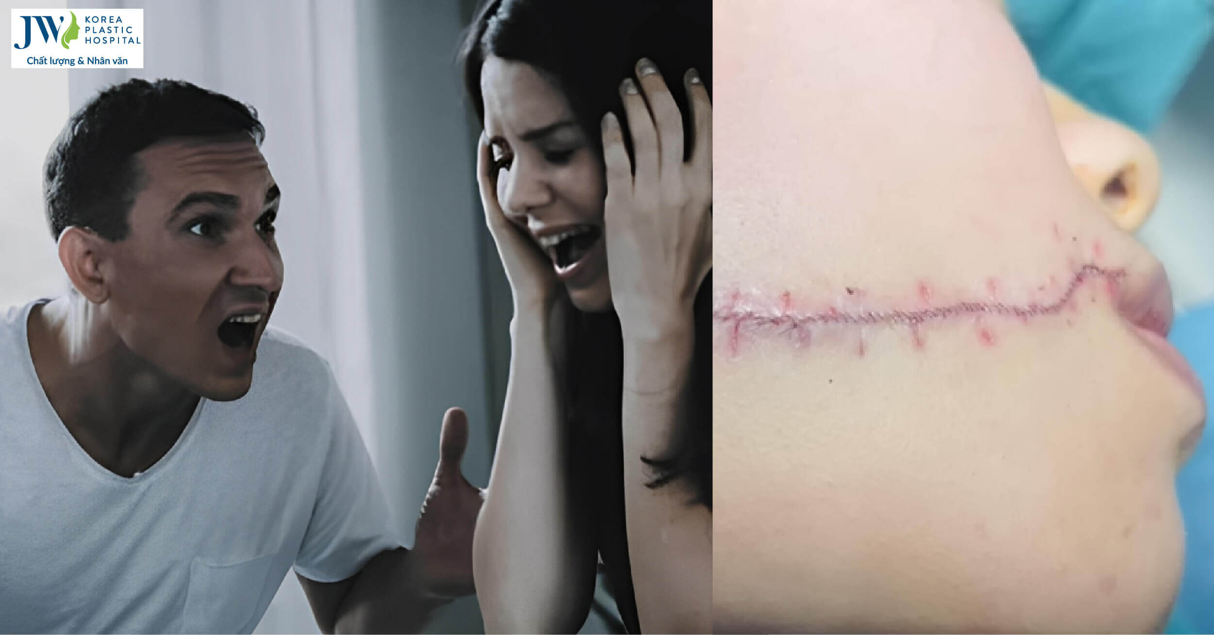 gia trưởng mới lo được cho em