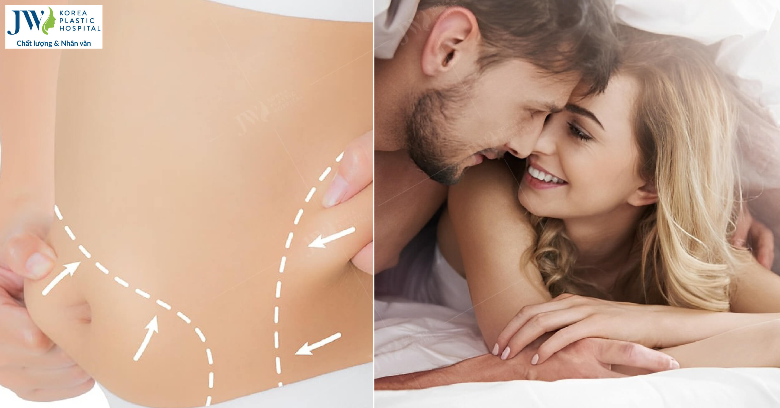 hút mỡ bụng kiêng quan hệ bao lâu