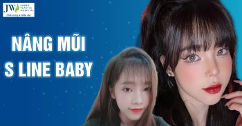 Nâng mũi S Line Baby