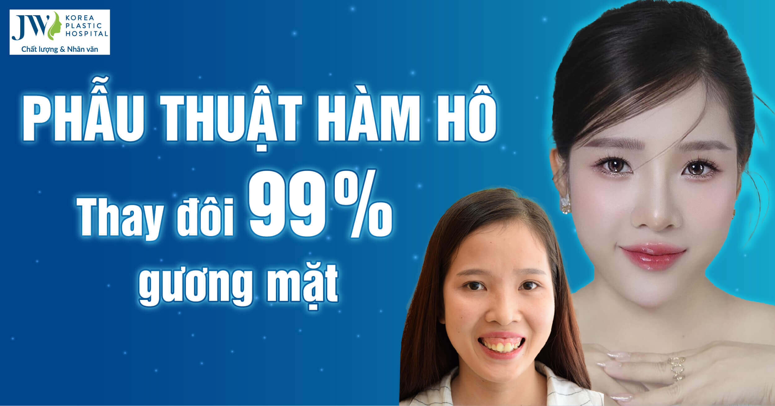 phẫu thuật hàm hô