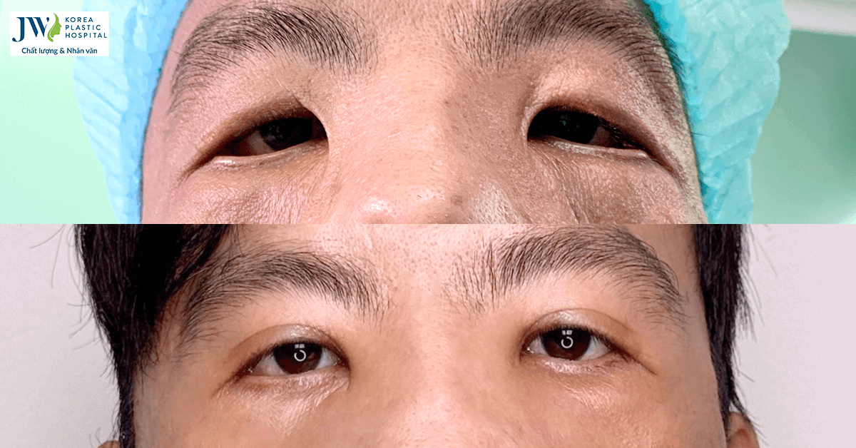 Anh Mến giờ ra sao