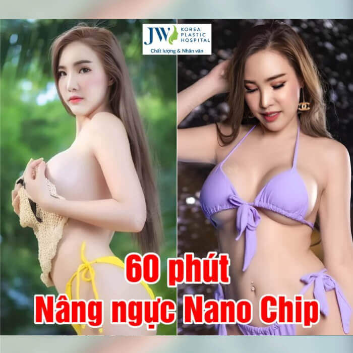 bo-anh-gai-xinh-dien-bikini-06-nang-nguc-nanochip-benh-vien-tham-my-jw