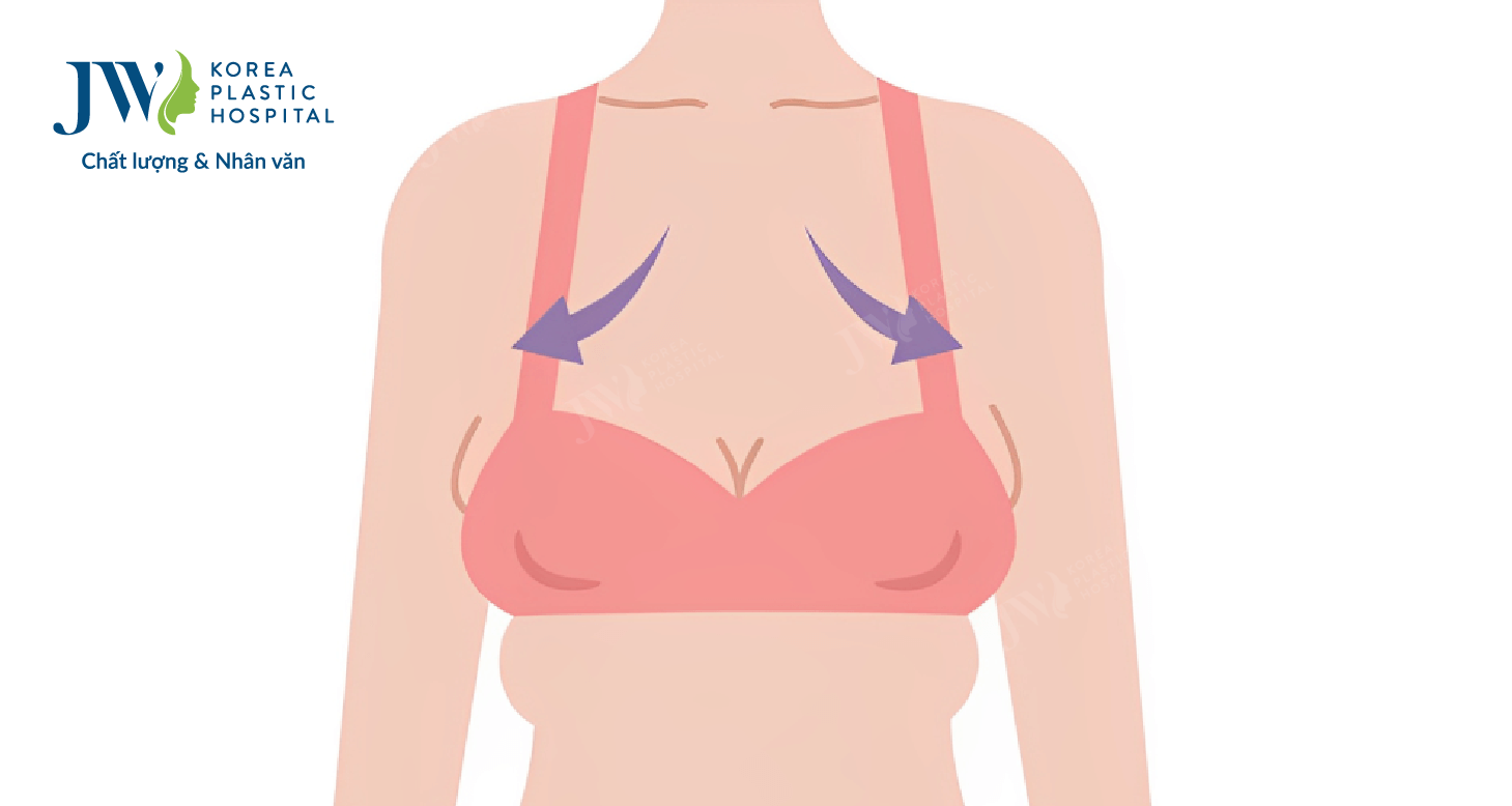 Cách chăm sóc ngực chảy xệ