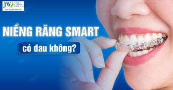 Niềng răng SMART có đau không? Quy trình niềng răng ra sao?