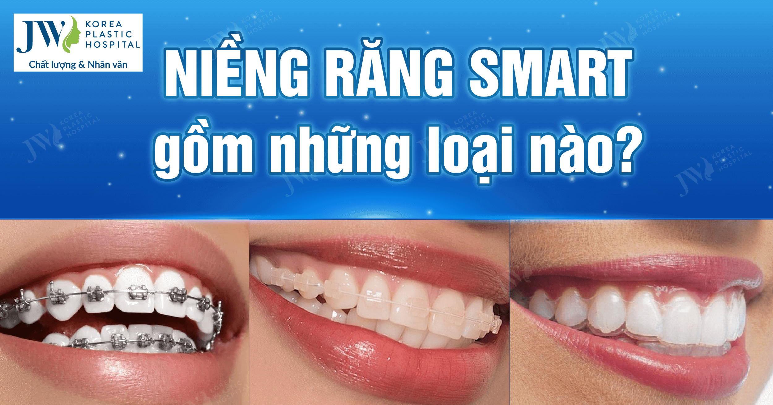 niềng răng SMART