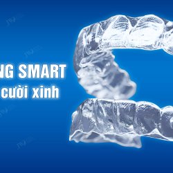 Chấn động: Niềng răng SMART sở hữu nụ cười tự tin