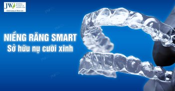 niềng răng SMART