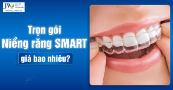 Trọn gói Niềng răng SMART giá bao nhiêu?