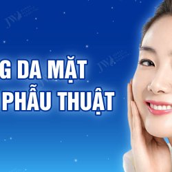 Căng da mặt – Phương pháp trẻ hóa không phẫu thuật