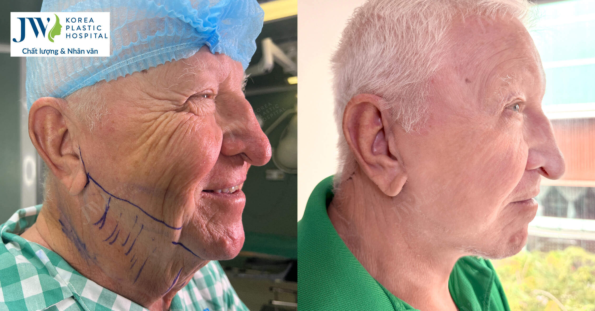 dich vu y te tại viet nam