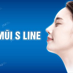 1000+ Hình ảnh gái xinh nâng mũi S Line tại Bệnh viện JW