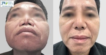 hoat dong kham chua benh