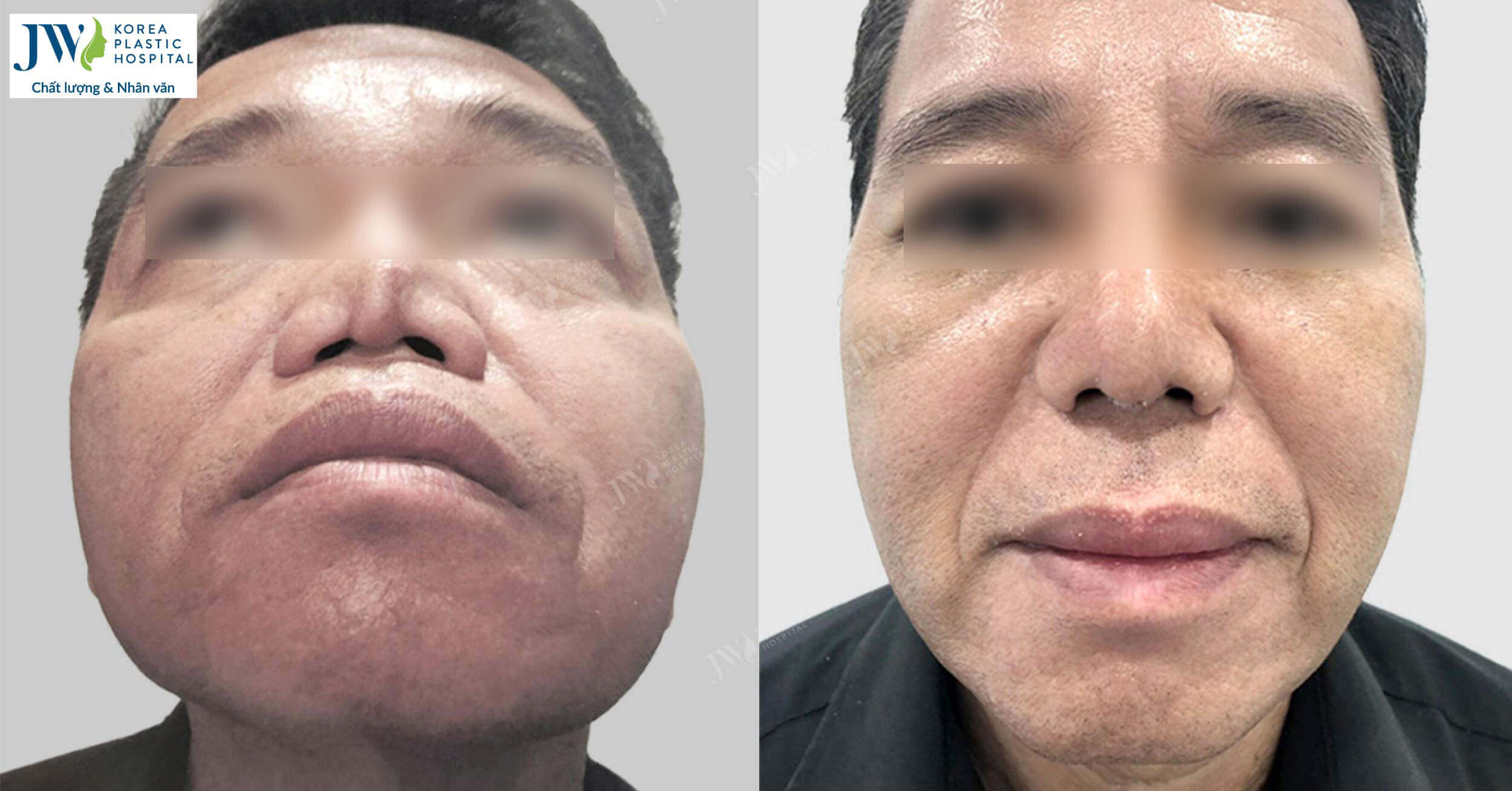 hoat dong kham chua benh