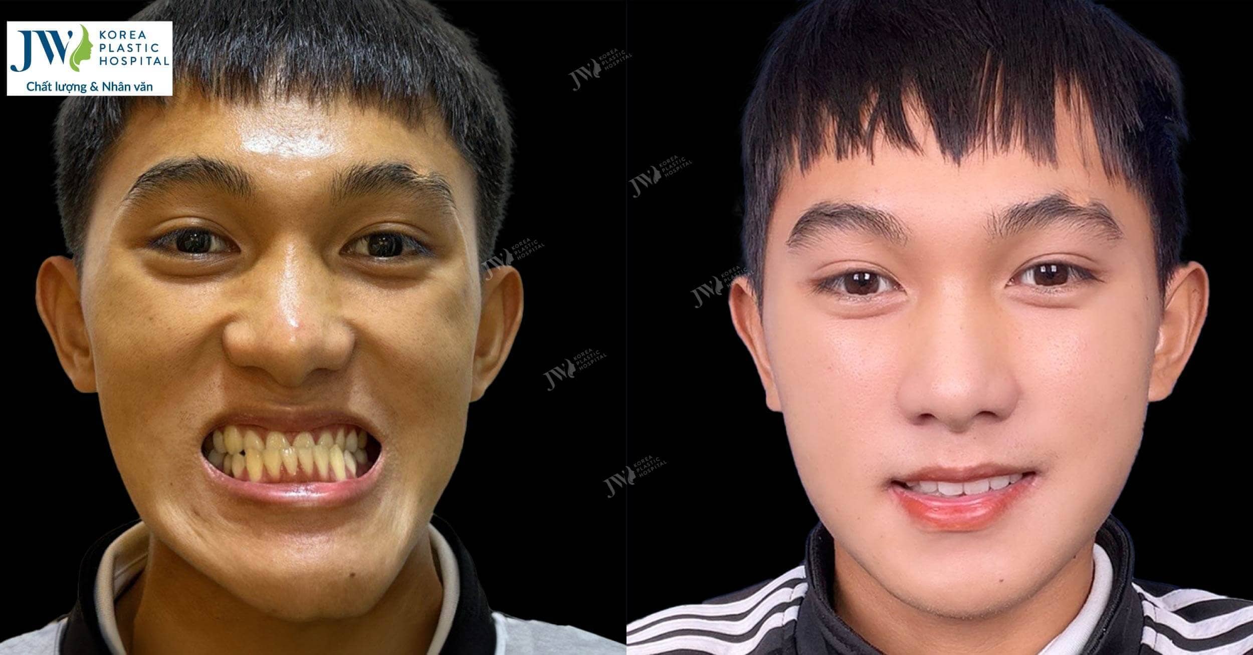 phau-thuat-ham-vu-minh-duc