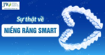 Sự thật về niềng răng SMART mà bạn nên biết
