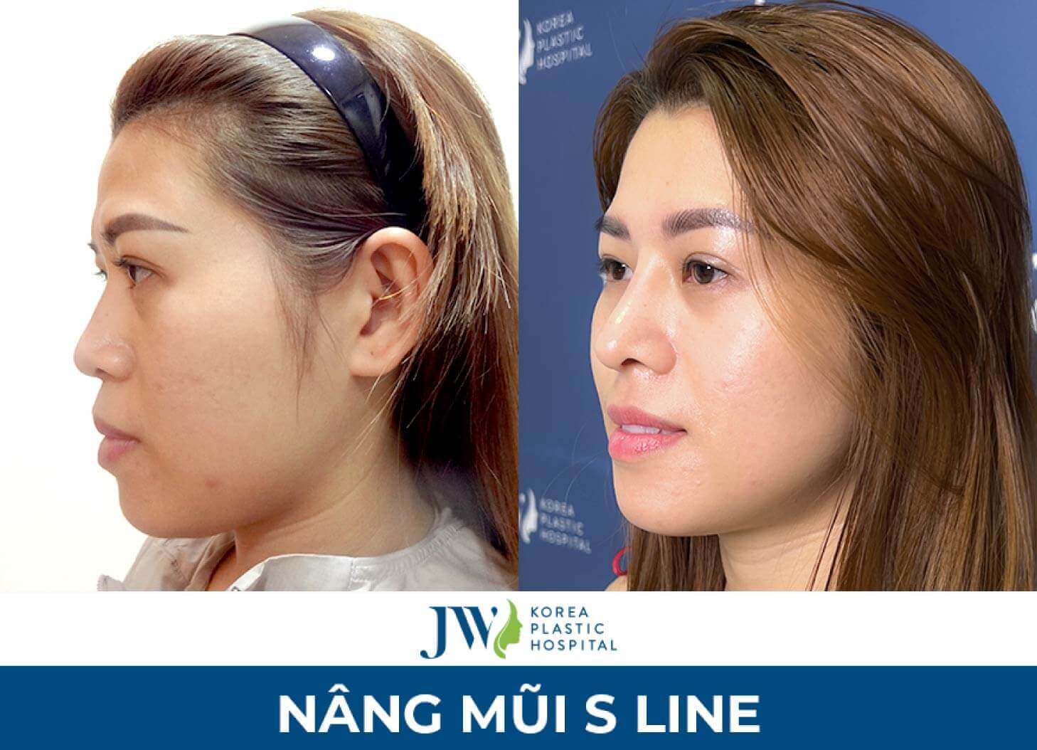 dia-chi-nang-mui-s-line-7