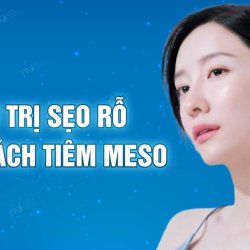 Điều trị sẹo rỗ bằng phương pháp tiêm Meso 