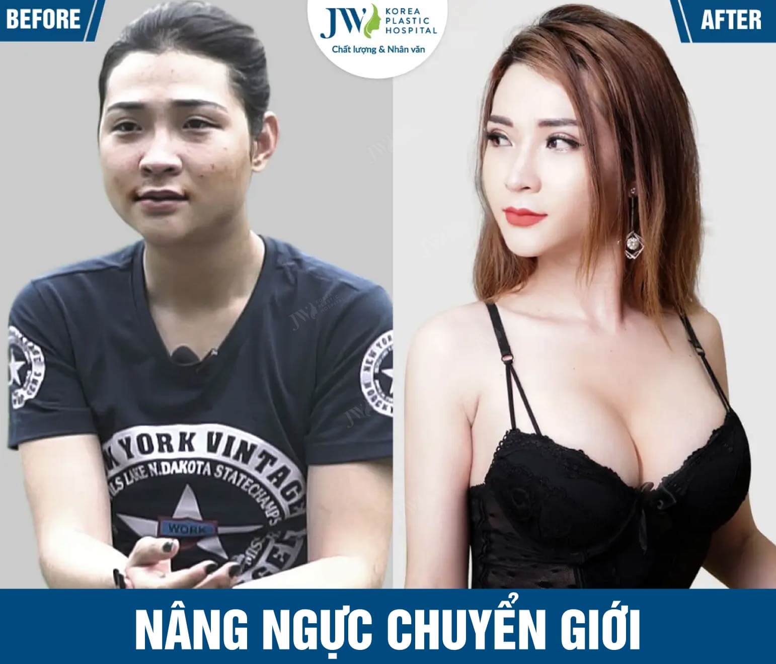 nang nguc chuyen gioi