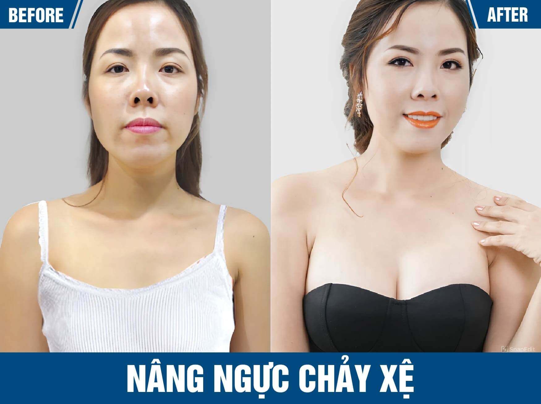 nang-nguc-chay-xe