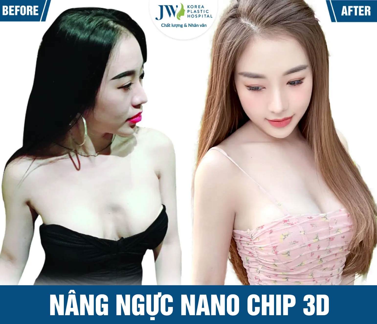 nang nguc nano chip