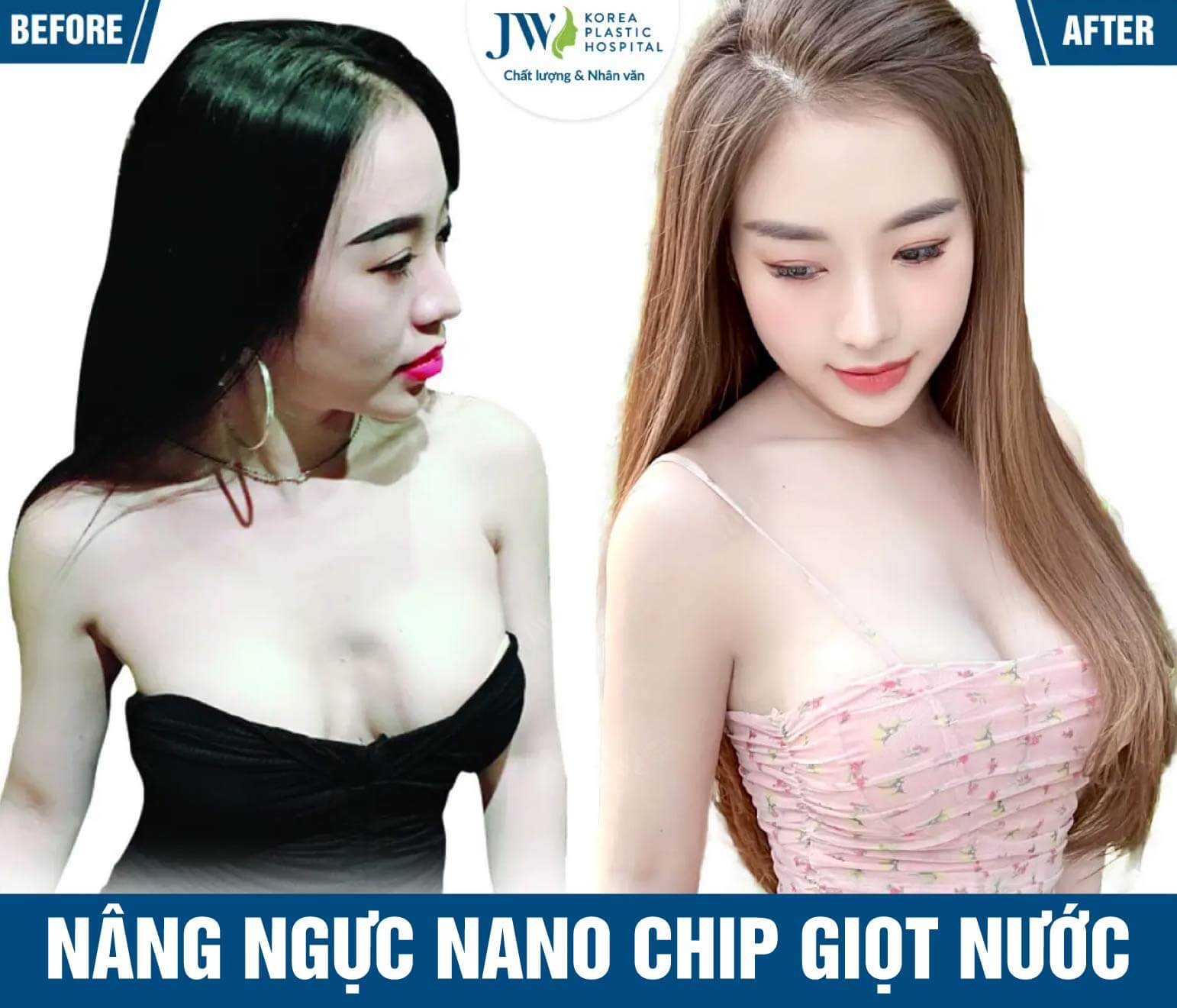 nang nguc nano chip