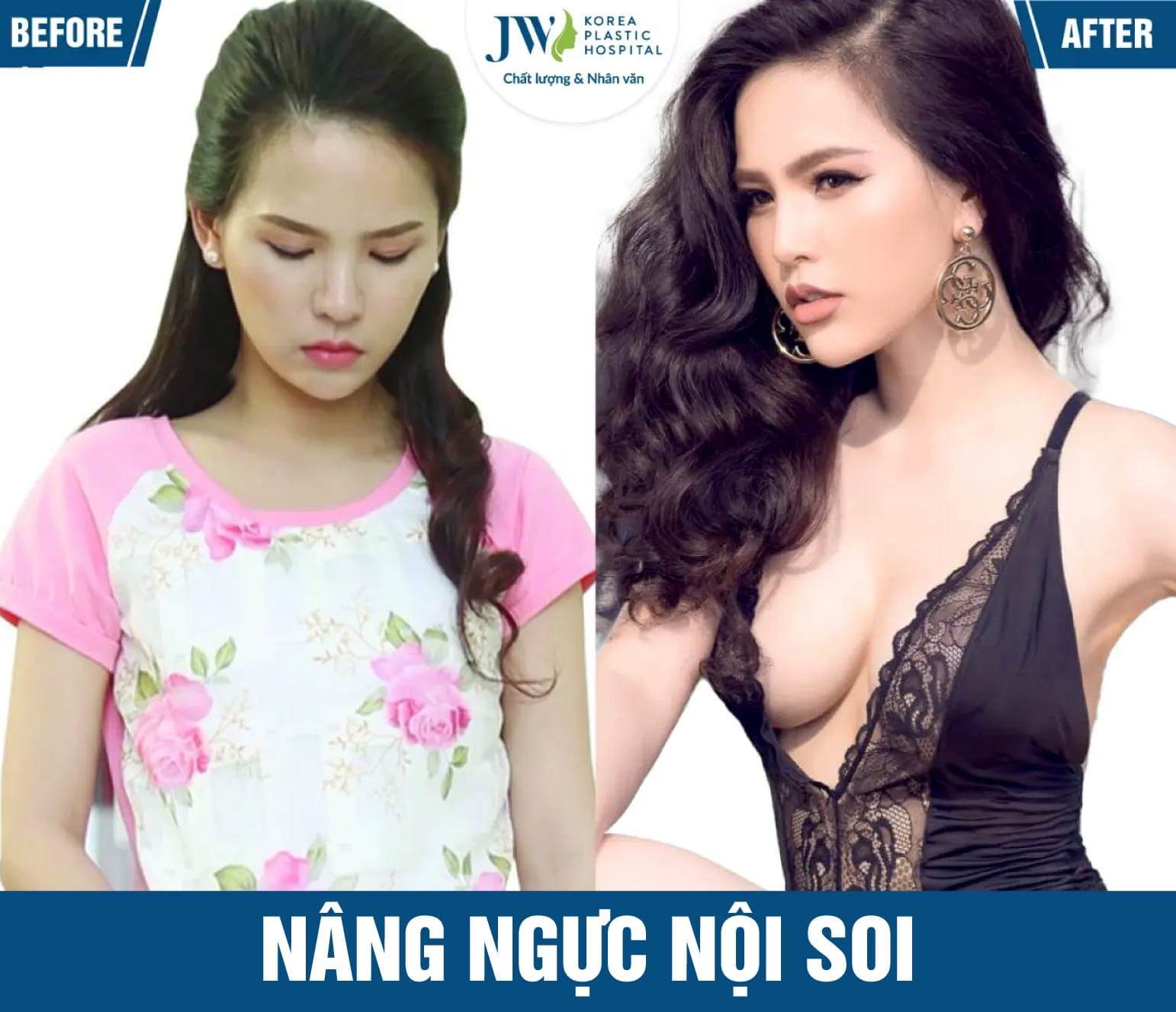 nang nguc noi soi