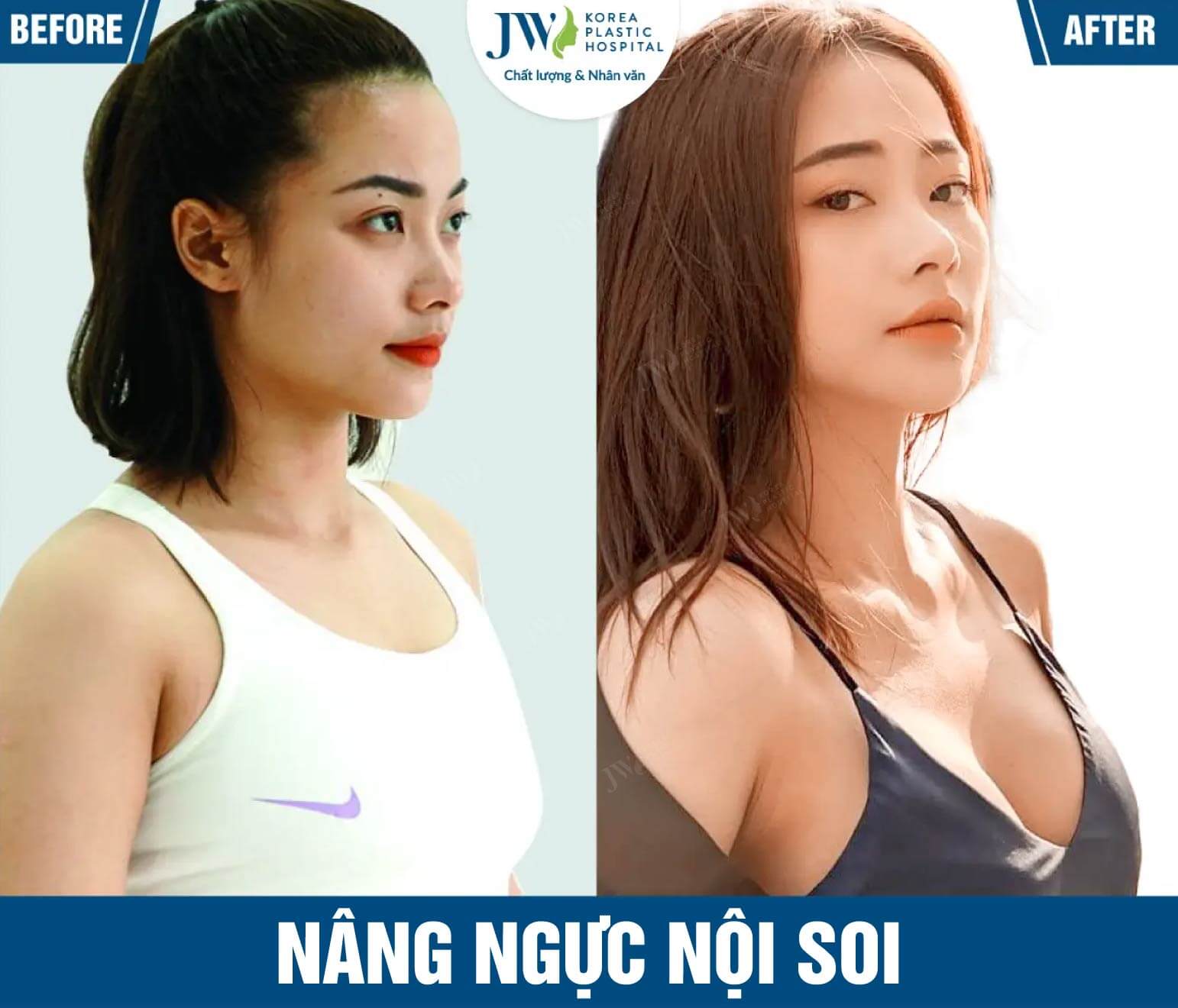 nang nguc noi soi