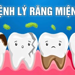 Nguyên nhân gây ra bệnh răng miệng và lưu ý cần thiết 