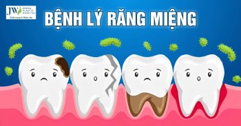 Nguyên nhân gây ra bệnh răng miệng và lưu ý cần thiết