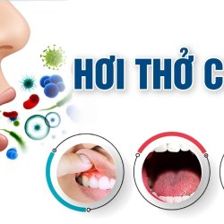 Nguyên nhân hơi thở có mùi xuất phát từ đâu?