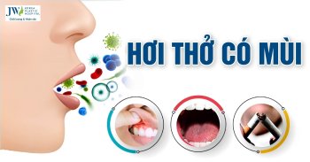 Nguyên nhân hơi thở có mùi xuất phát từ đâu?