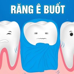 Nguyên nhân khiến răng ê buốt và cách xử lý hiệu quả