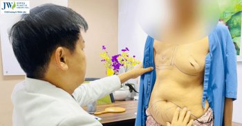 Tái tạo vú sau ung thư giúp mang lại sự tự tin cơ thể