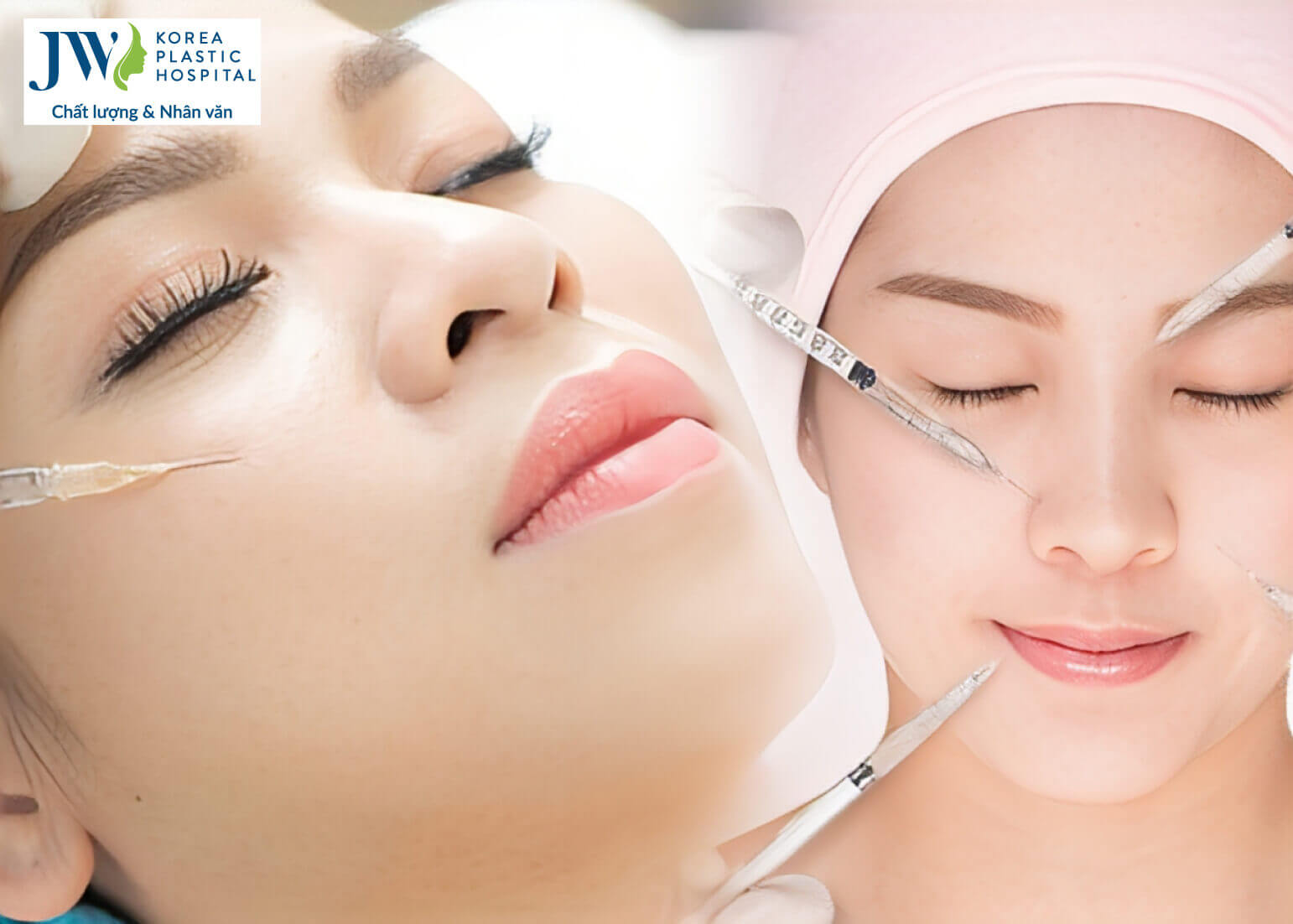 filler-co-bao-nhieu-loai