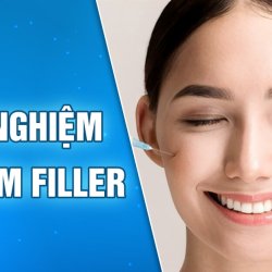 Kinh nghiệm tiêm Filler những điều bạn nên biết trước và sau khi tiêm 